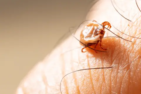Spider Mite Bites on Humans